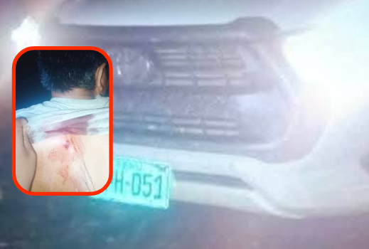 Sandia | Hombre resulta herido durante intervención policial en Alto Inambari